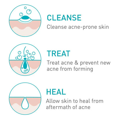 CeraVe Acne Foaming Cream Cleanser 4%