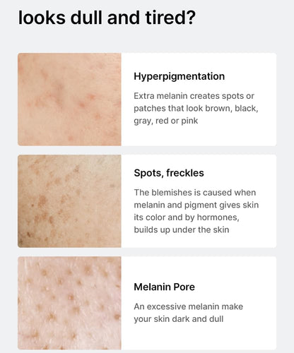 CELIMAX PORE+DARK SPOT BRIGHTENING SERUM