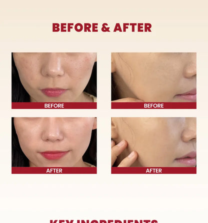 K-SECRET - SEOUL 1988 Snail Mucin 93% + Rice Cream 100ml