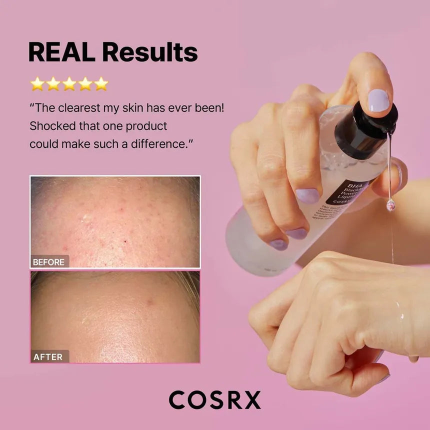 COSRX - BHA Blackhead Power Liquid 100ml